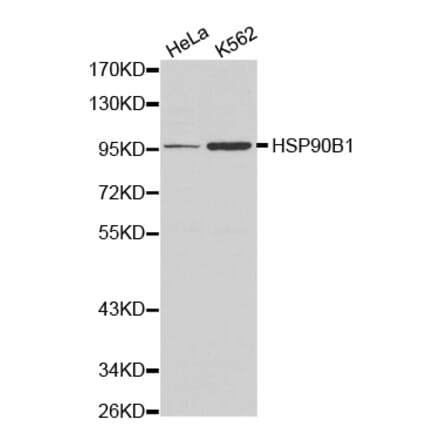 Western blot - HSP90B1 antibody from Signalway Antibody (38161) - Antibodies.com