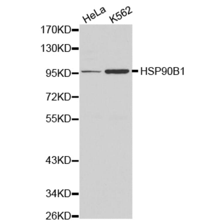 Western blot - HSP90B1 antibody from Signalway Antibody (38161) - Antibodies.com