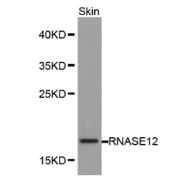 Western blot - RNASE12 antibody from Signalway Antibody (38175) - Antibodies.com