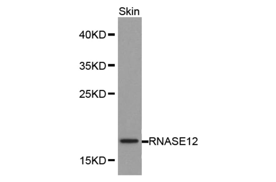Western blot - RNASE12 antibody from Signalway Antibody (38175) - Antibodies.com