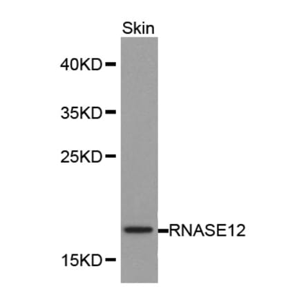 Western blot - RNASE12 antibody from Signalway Antibody (38175) - Antibodies.com