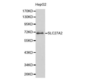 Western blot - SLC27A2 antibody from Signalway Antibody (38177) - Antibodies.com