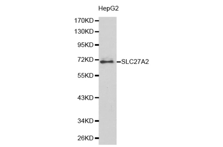 Western blot - SLC27A2 antibody from Signalway Antibody (38177) - Antibodies.com