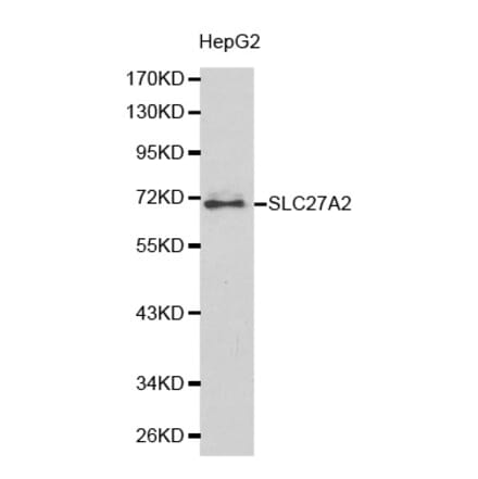 Western blot - SLC27A2 antibody from Signalway Antibody (38177) - Antibodies.com