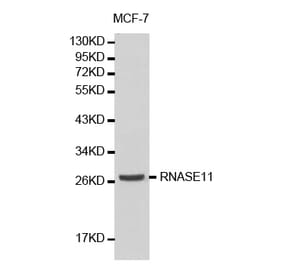 Western blot - RNASE11 antibody from Signalway Antibody (38185) - Antibodies.com