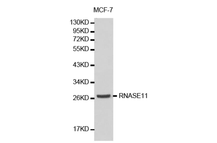 Western blot - RNASE11 antibody from Signalway Antibody (38185) - Antibodies.com