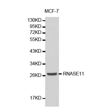 Western blot - RNASE11 antibody from Signalway Antibody (38185) - Antibodies.com