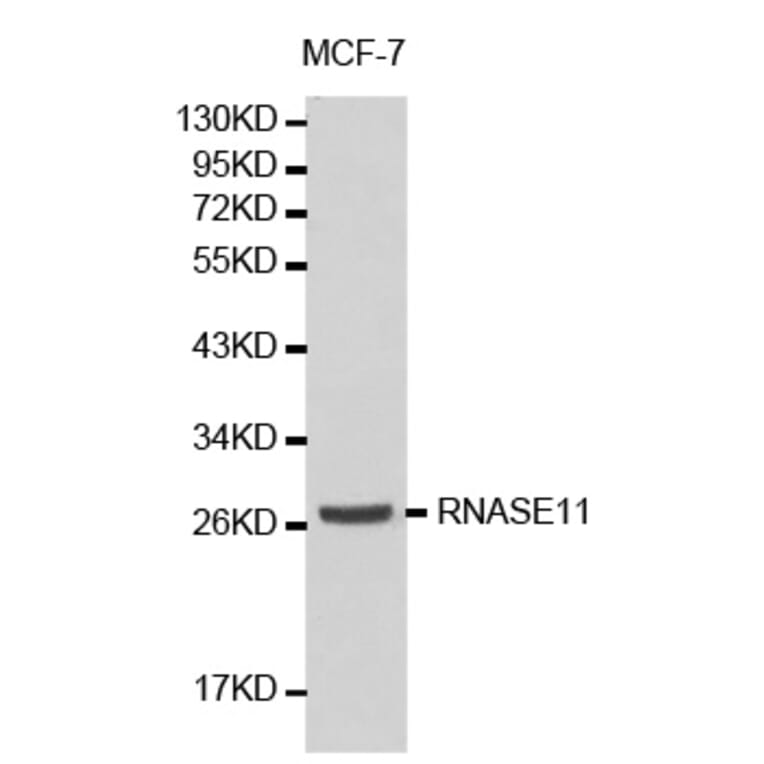 Western blot - RNASE11 antibody from Signalway Antibody (38185) - Antibodies.com