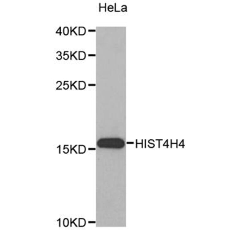 Western blot - HIST4H4 antibody from Signalway Antibody (38198) - Antibodies.com