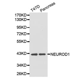 Western blot - NEUROD1 antibody from Signalway Antibody (38203) - Antibodies.com