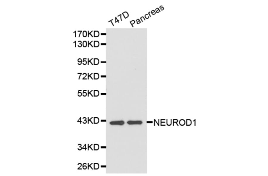 Western blot - NEUROD1 antibody from Signalway Antibody (38203) - Antibodies.com