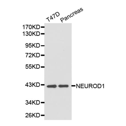 Western blot - NEUROD1 antibody from Signalway Antibody (38203) - Antibodies.com