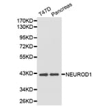 Western blot - NEUROD1 antibody from Signalway Antibody (38203) - Antibodies.com