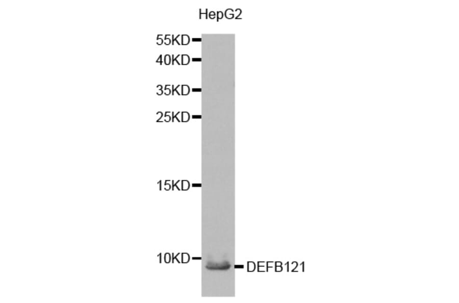 Western blot - DEFB121 antibody from Signalway Antibody (38216) - Antibodies.com