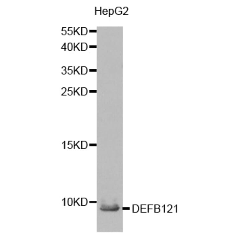 Western blot - DEFB121 antibody from Signalway Antibody (38216) - Antibodies.com