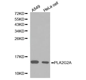 Western blot - PLA2G2A antibody from Signalway Antibody (38223) - Antibodies.com