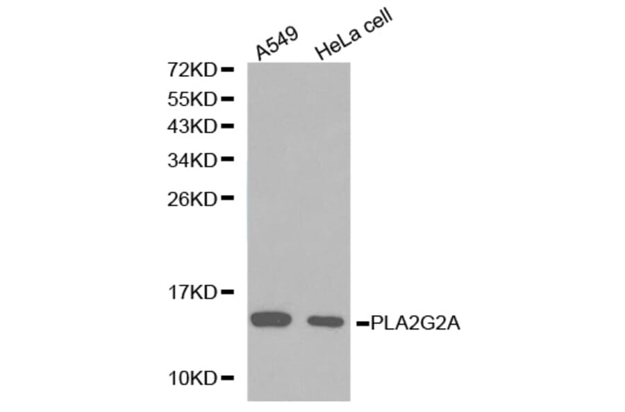 Western blot - PLA2G2A antibody from Signalway Antibody (38223) - Antibodies.com