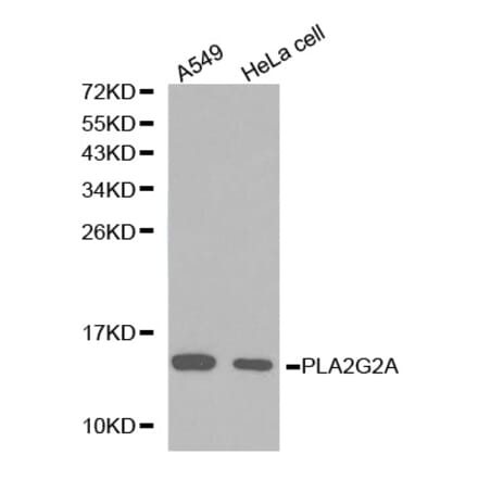Western blot - PLA2G2A antibody from Signalway Antibody (38223) - Antibodies.com