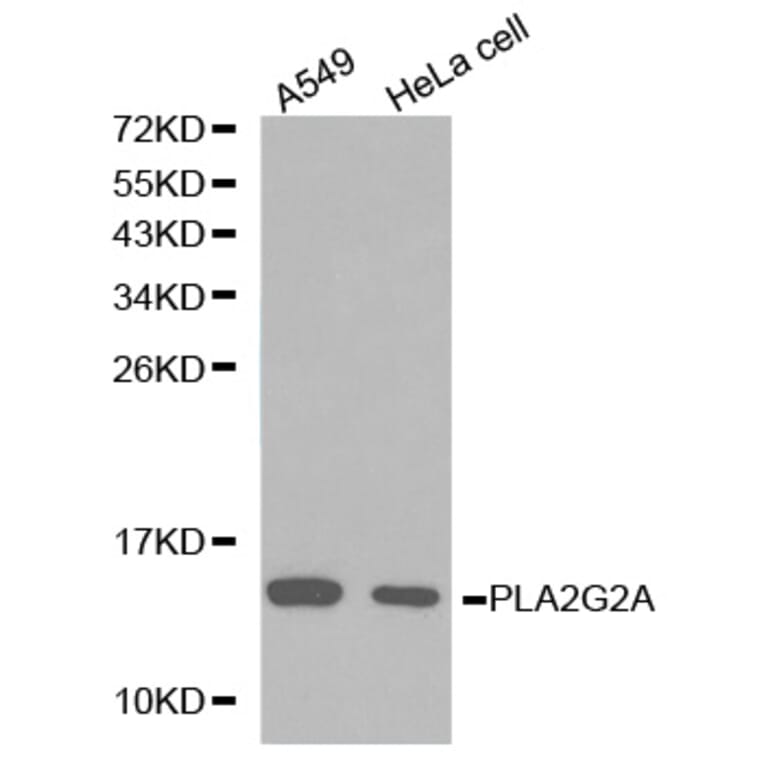 Western blot - PLA2G2A antibody from Signalway Antibody (38223) - Antibodies.com
