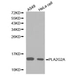 Western blot - PLA2G2A antibody from Signalway Antibody (38223) - Antibodies.com