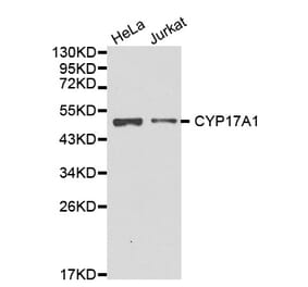 Western blot - CYP17A1 antibody from Signalway Antibody (38233) - Antibodies.com