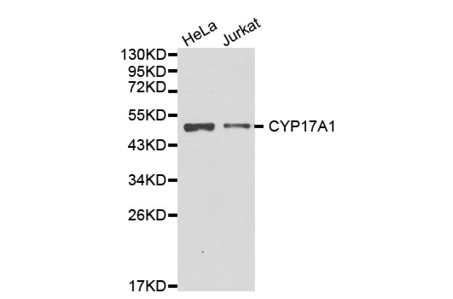 Western blot - CYP17A1 antibody from Signalway Antibody (38233) - Antibodies.com