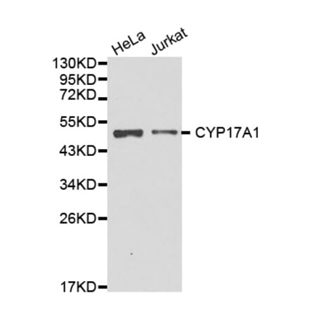 Western blot - CYP17A1 antibody from Signalway Antibody (38233) - Antibodies.com