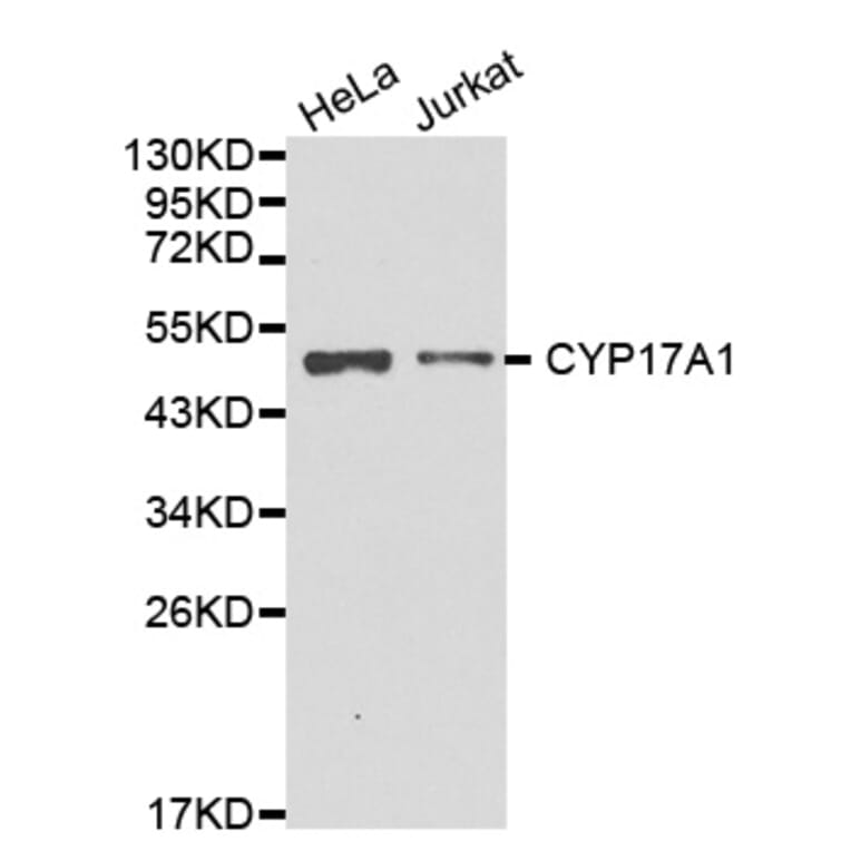 Western blot - CYP17A1 antibody from Signalway Antibody (38233) - Antibodies.com