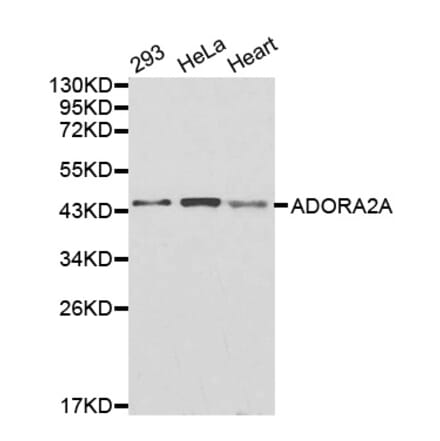 Western blot - ADORA2A antibody from Signalway Antibody (38260) - Antibodies.com