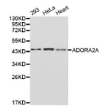 Western blot - ADORA2A antibody from Signalway Antibody (38260) - Antibodies.com
