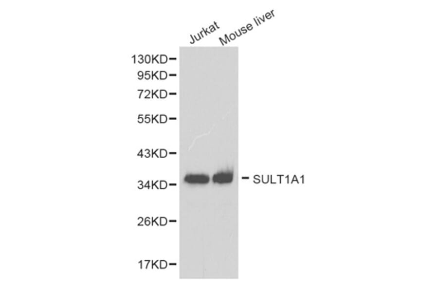 Western blot - SULT1A1 antibody from Signalway Antibody (38264) - Antibodies.com