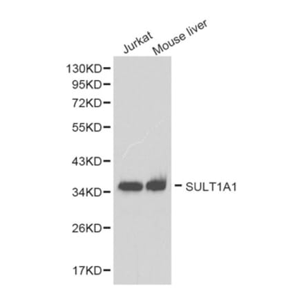 Western blot - SULT1A1 antibody from Signalway Antibody (38264) - Antibodies.com