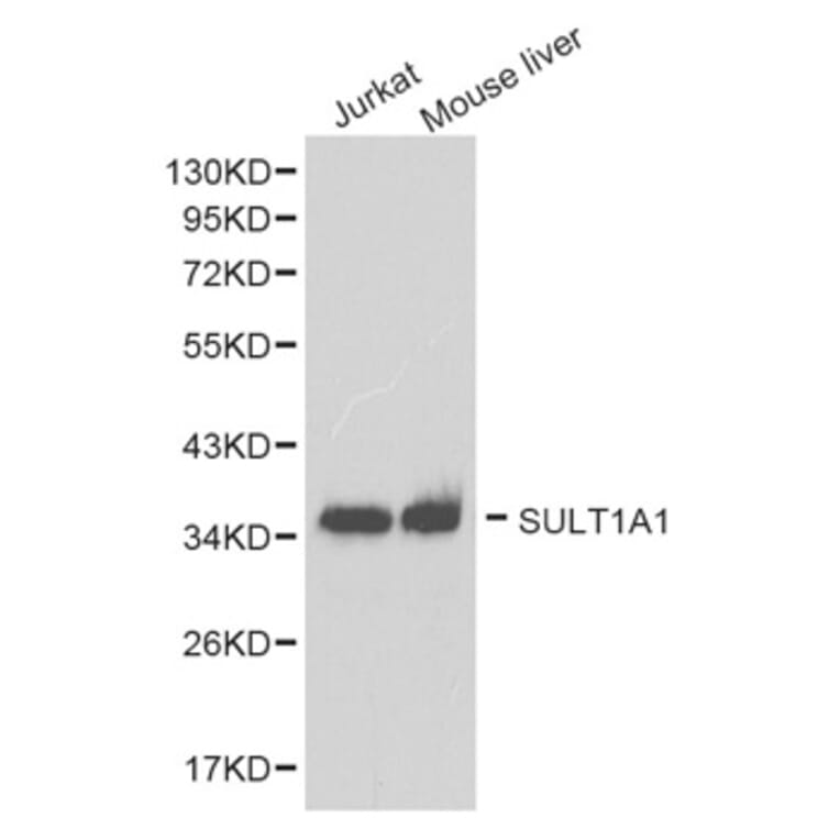 Western blot - SULT1A1 antibody from Signalway Antibody (38264) - Antibodies.com