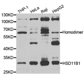 Western blot - HSD11B1 antibody from Signalway Antibody (38269) - Antibodies.com