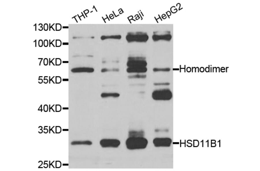 Western blot - HSD11B1 antibody from Signalway Antibody (38269) - Antibodies.com