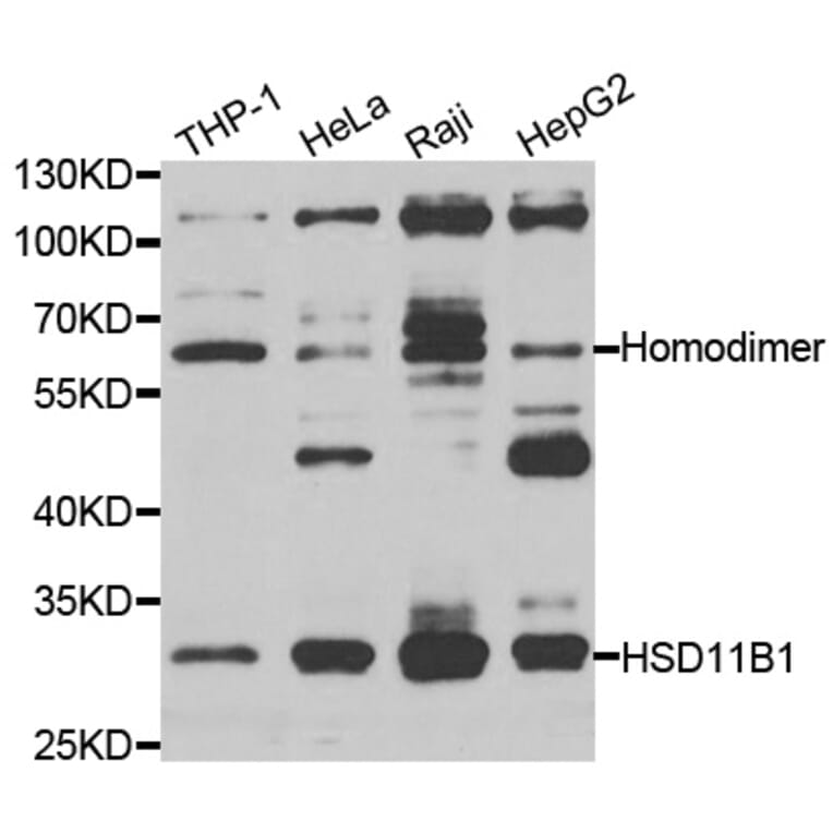 Western blot - HSD11B1 antibody from Signalway Antibody (38269) - Antibodies.com