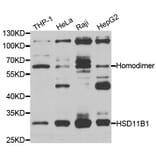 Western blot - HSD11B1 antibody from Signalway Antibody (38269) - Antibodies.com