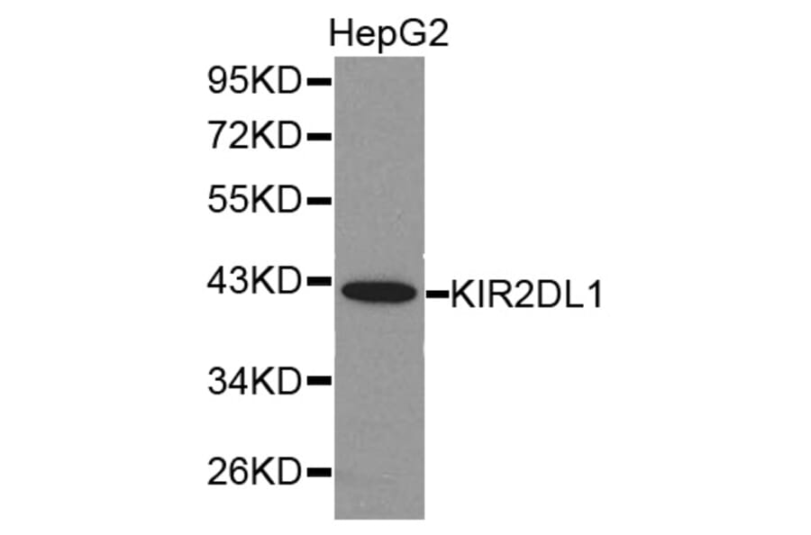 Western blot - KIR2DL1 antibody from Signalway Antibody (38283) - Antibodies.com
