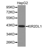 Western blot - KIR2DL1 antibody from Signalway Antibody (38283) - Antibodies.com