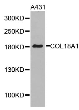 Western blot analysis of extracts of A431 cell lines, using COL18A1 antibody.