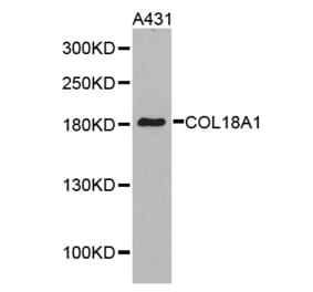 Western blot - COL18A1 antibody from Signalway Antibody (38287) - Antibodies.com