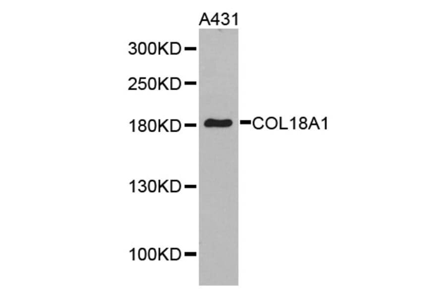 Western blot - COL18A1 antibody from Signalway Antibody (38287) - Antibodies.com