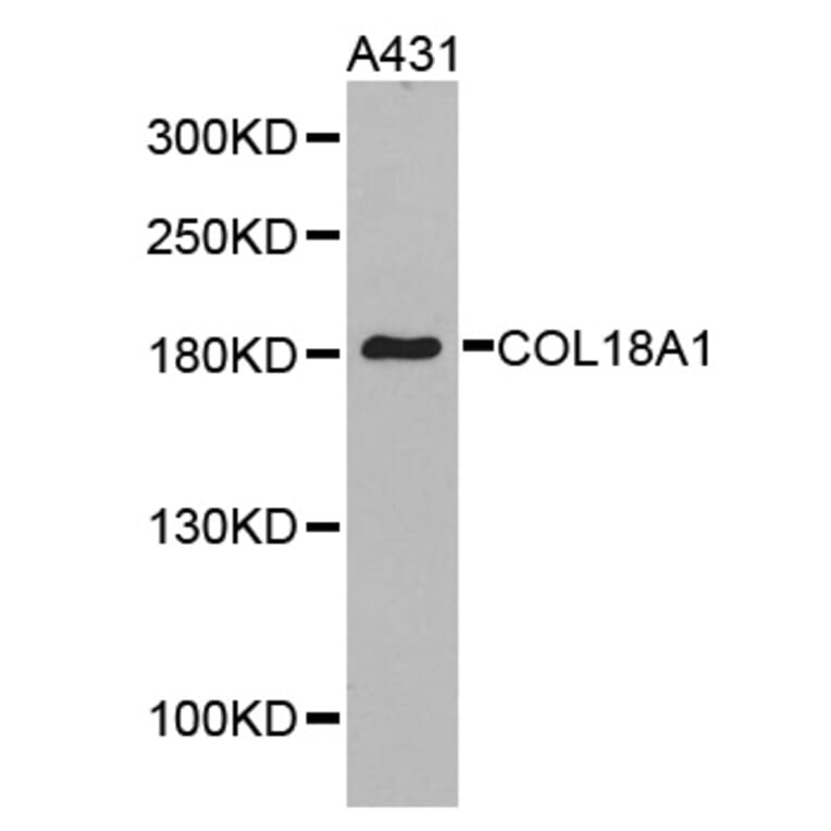 Western blot - COL18A1 antibody from Signalway Antibody (38287) - Antibodies.com