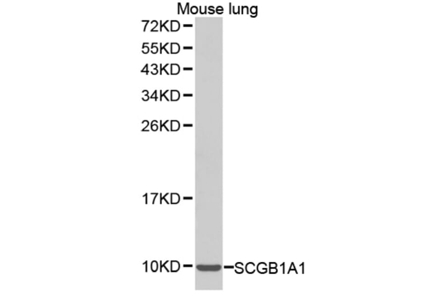 Western blot - SCGB1A1 antibody from Signalway Antibody (38290) - Antibodies.com