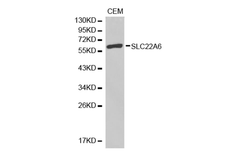 Western blot - SLC22A6 antibody from Signalway Antibody (38304) - Antibodies.com