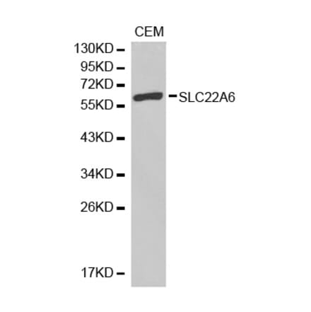 Western blot - SLC22A6 antibody from Signalway Antibody (38304) - Antibodies.com