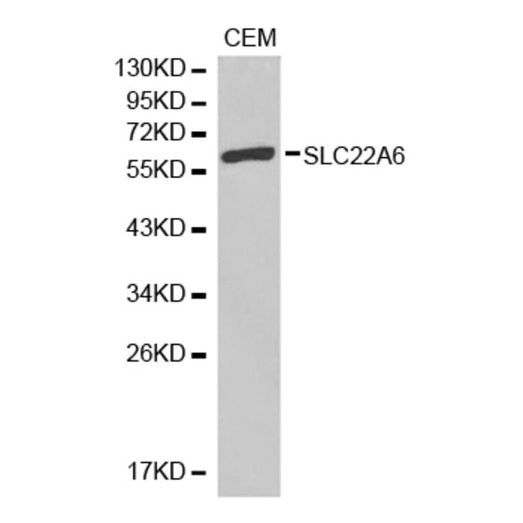Western blot - SLC22A6 antibody from Signalway Antibody (38304) - Antibodies.com