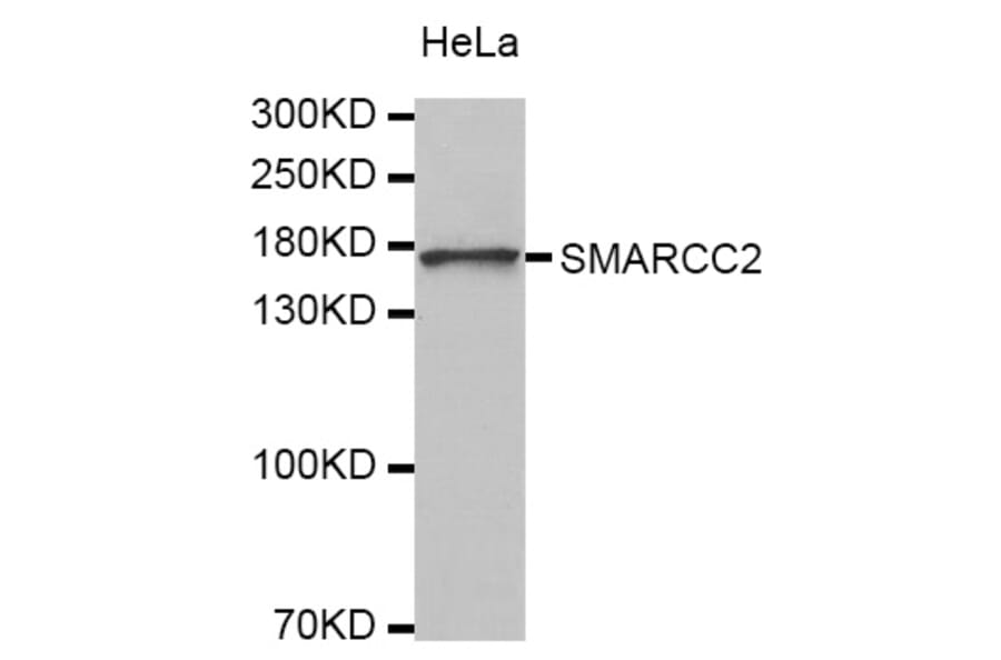 Western blot - SMARCC2 antibody from Signalway Antibody (38327) - Antibodies.com