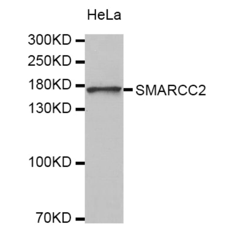 Western blot - SMARCC2 antibody from Signalway Antibody (38327) - Antibodies.com