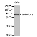 Western blot - SMARCC2 antibody from Signalway Antibody (38327) - Antibodies.com